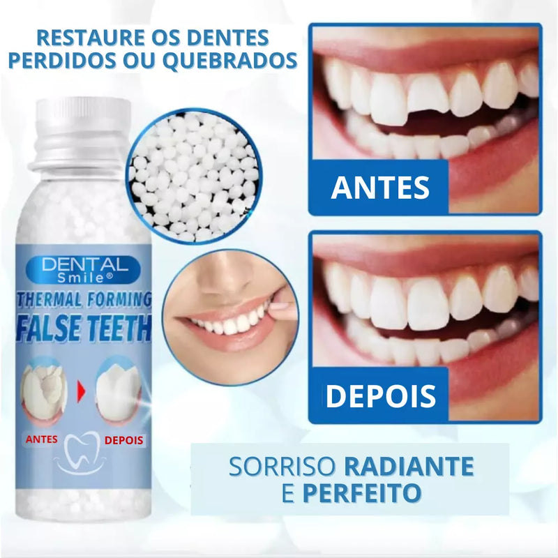Resina Dental SmileFix